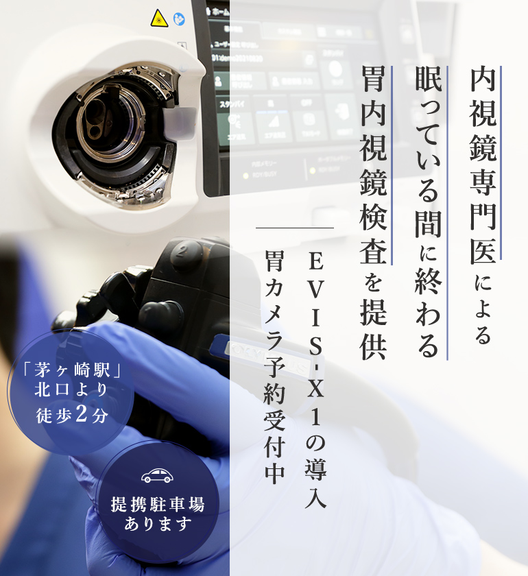 内視鏡専門医による眠っている間に終わる胃内視鏡検査を提供EVIS-X1の導入胃カメラ予約受付中「茅ヶ崎駅」北口より徒歩2分