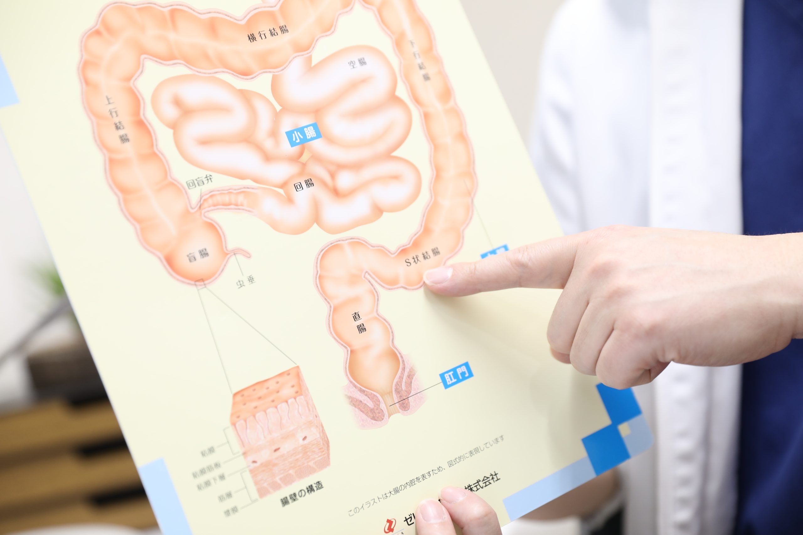 切除手術を受けた場合の注意事項